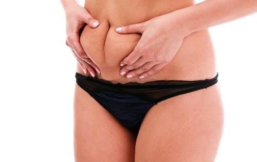 gordura-abdominal-500×334