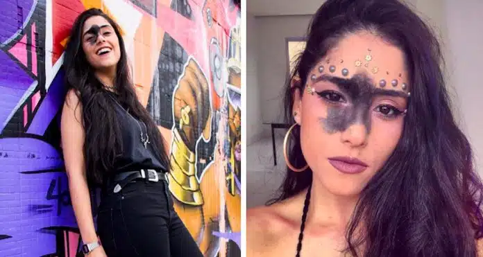 jovem-brasileira-com-rara-marca-de-nascenca-no-rosto-torna-se-numa-estrela-das-redes-sociais Jovem brasileira com rara marca de nascença no rosto torna-se numa estrela das redes sociais
