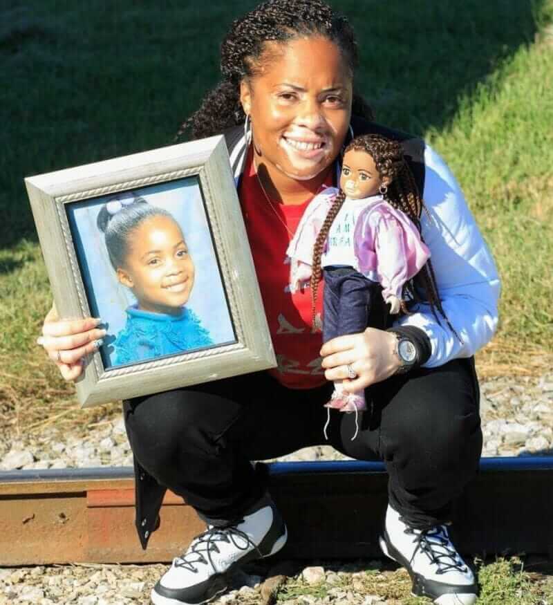 sabiaspalavras.com - Bonecas com vitiligo ajudam crianças com mesma condição a gostarem de si mesmas