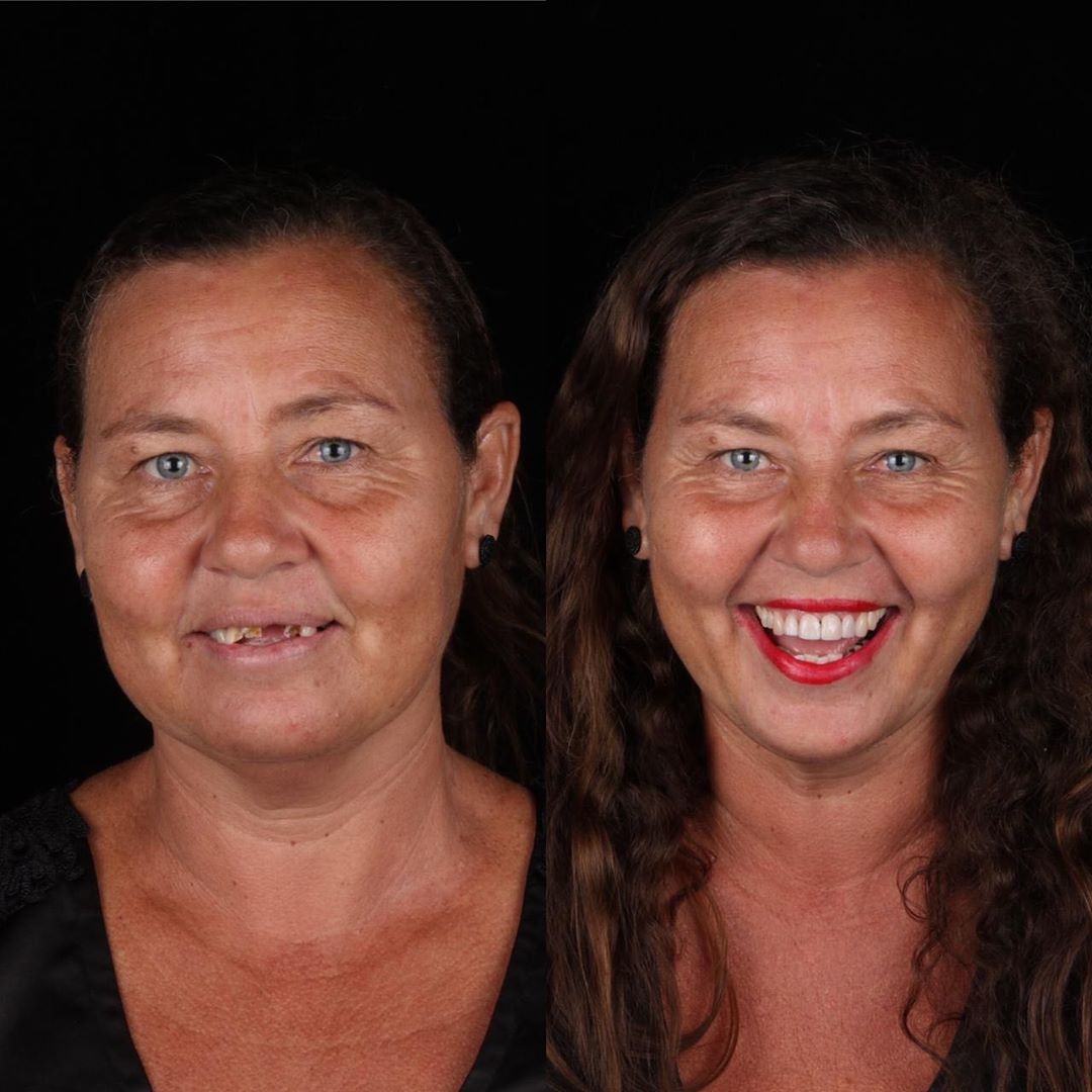 Dentista brasileiro trata dentes de pessoas pobres gratuitamente sabiaspalavras.com - Dentista brasileiro trata dentes de pessoas pobres gratuitamente