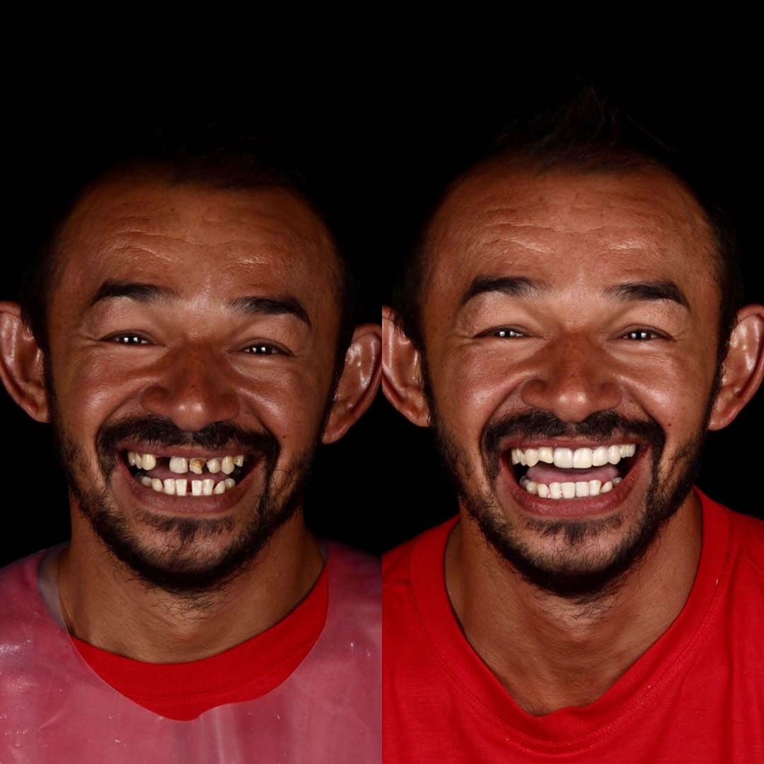 Dentista brasileiro trata dentes de pessoas pobres gratuitamente sabiaspalavras.com - Dentista brasileiro trata dentes de pessoas pobres gratuitamente