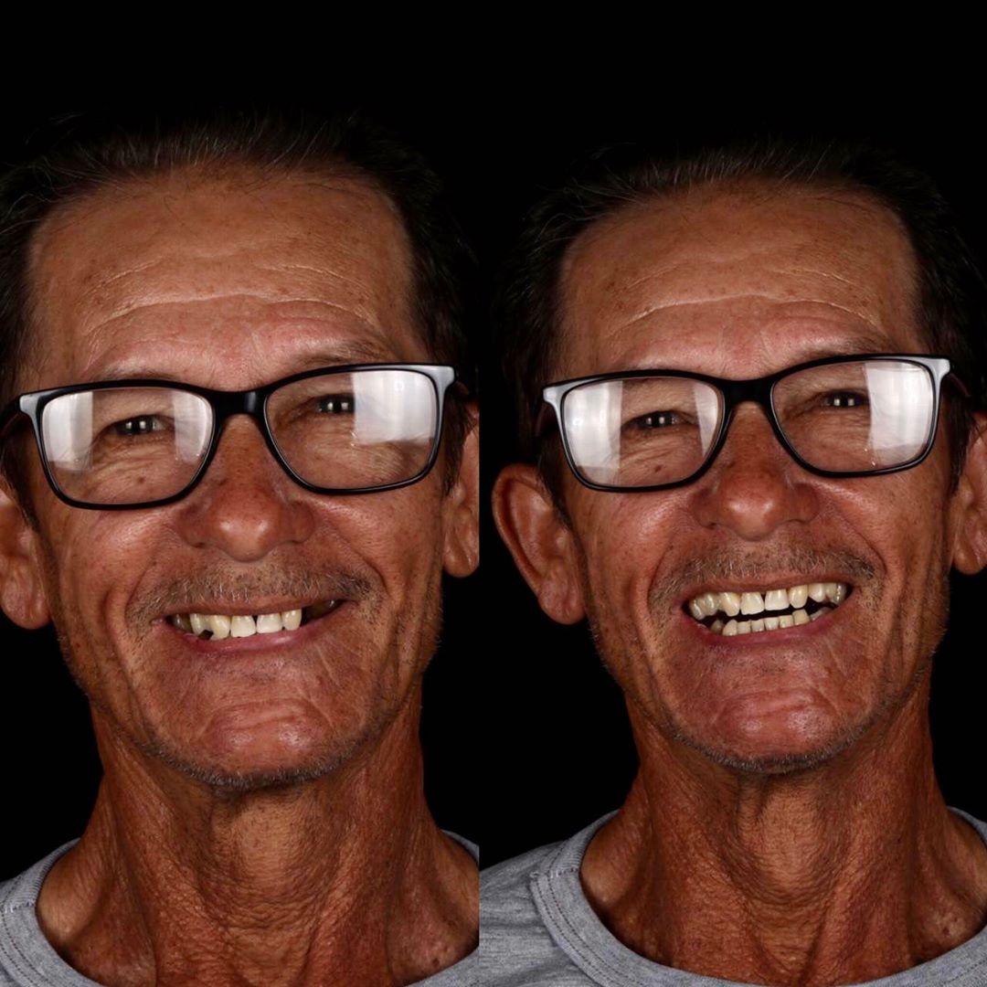 Dentista brasileiro trata dentes de pessoas pobres gratuitamente sabiaspalavras.com - Dentista brasileiro trata dentes de pessoas pobres gratuitamente