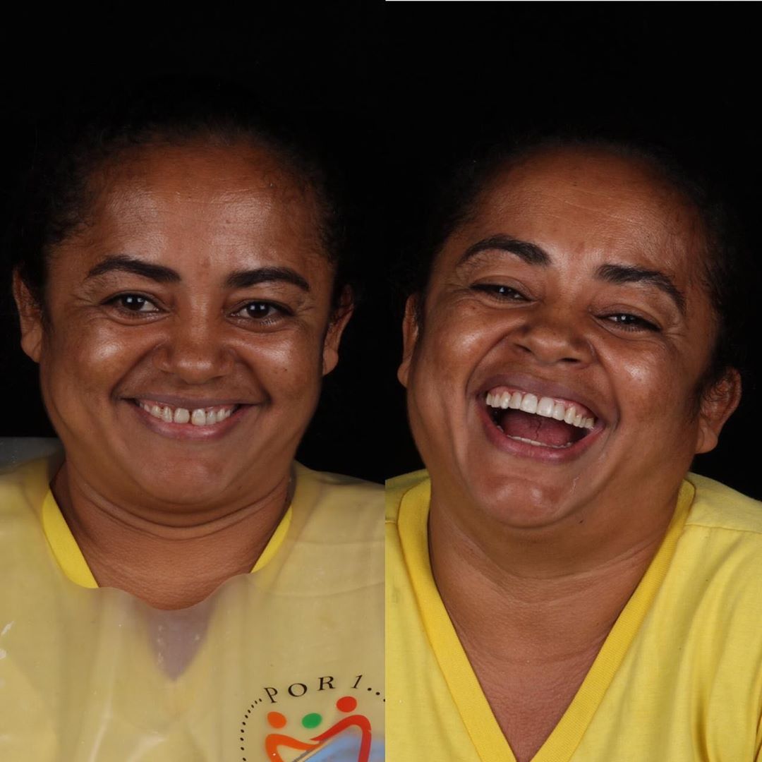 Dentista brasileiro trata dentes de pessoas pobres gratuitamente sabiaspalavras.com - Dentista brasileiro trata dentes de pessoas pobres gratuitamente