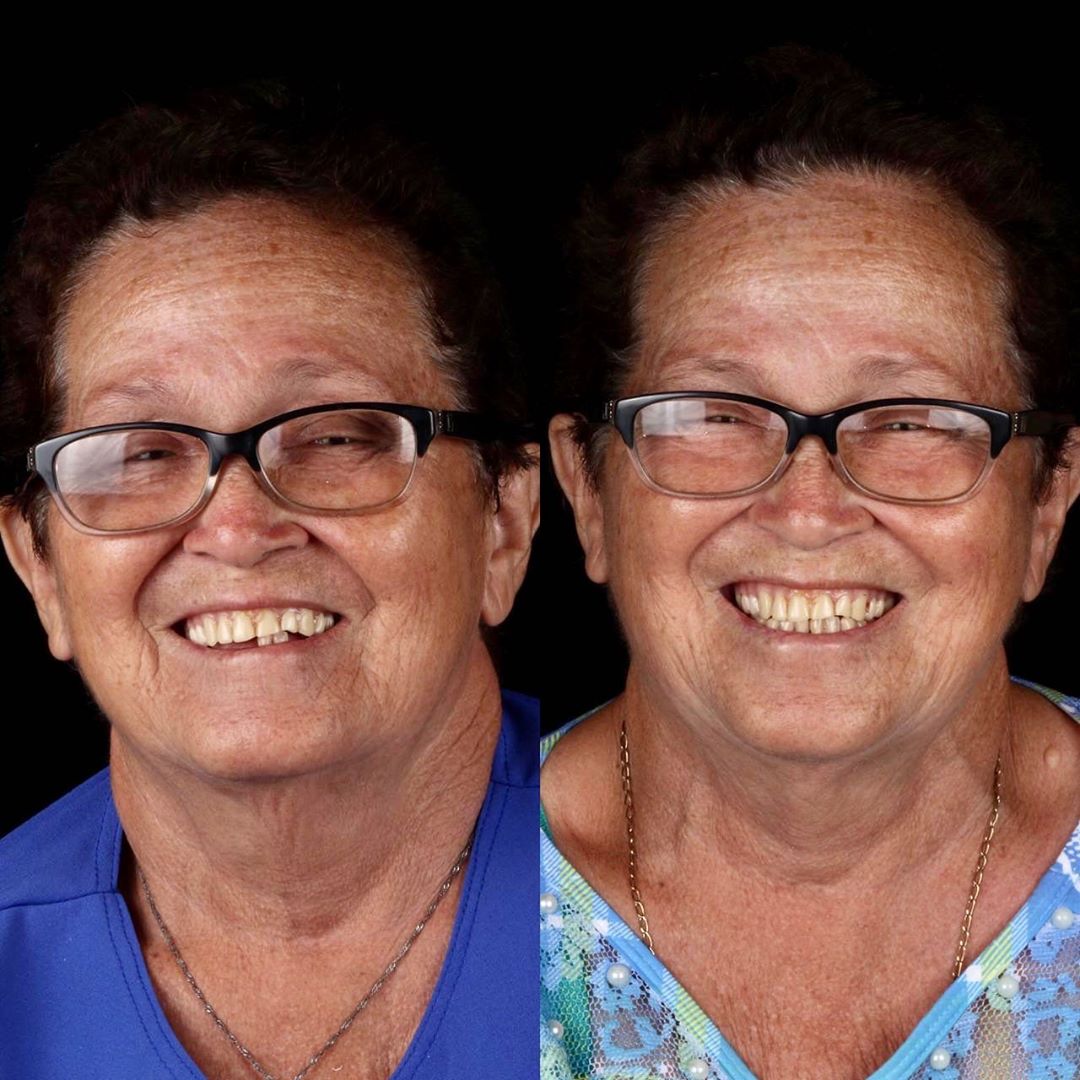 Dentista brasileiro trata dentes de pessoas pobres gratuitamente sabiaspalavras.com - Dentista brasileiro trata dentes de pessoas pobres gratuitamente