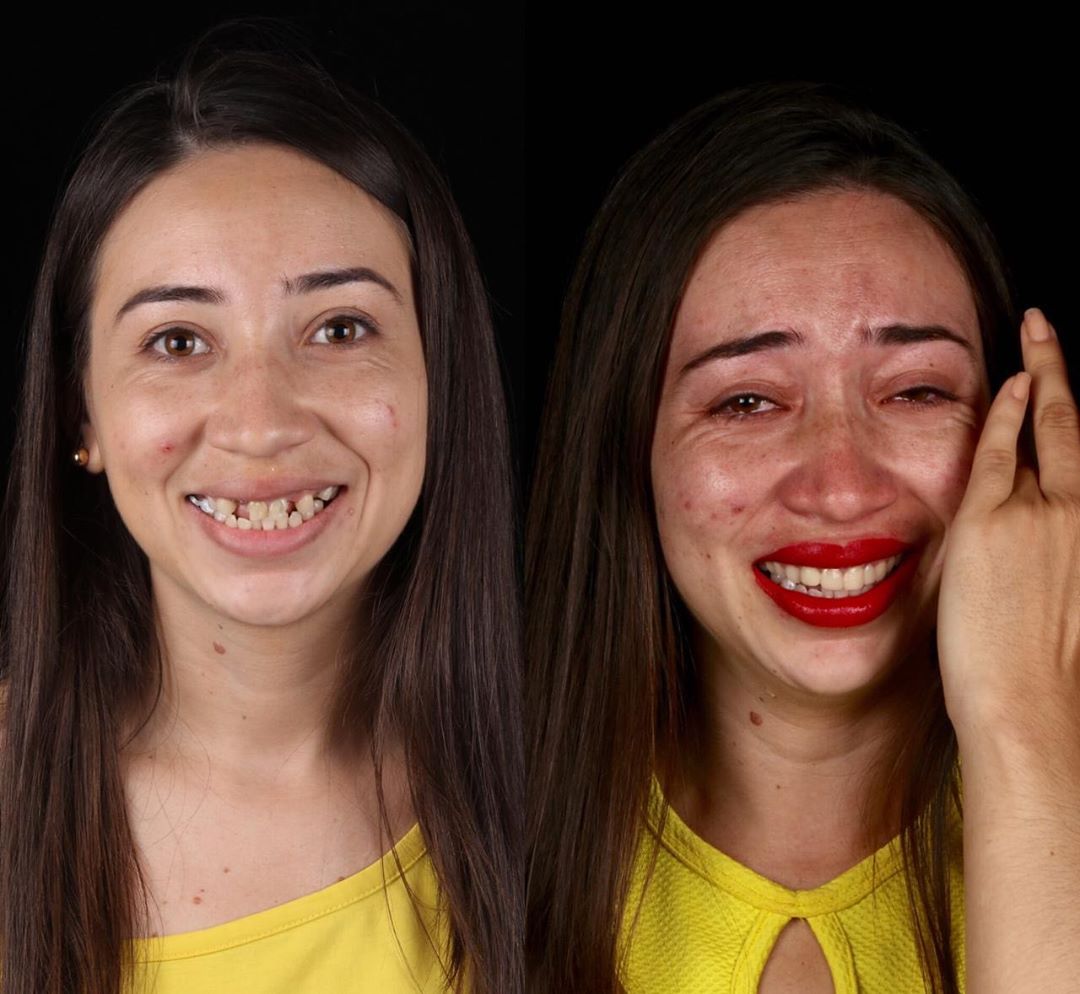 Dentista brasileiro trata dentes de pessoas pobres gratuitamente sabiaspalavras.com - Dentista brasileiro trata dentes de pessoas pobres gratuitamente