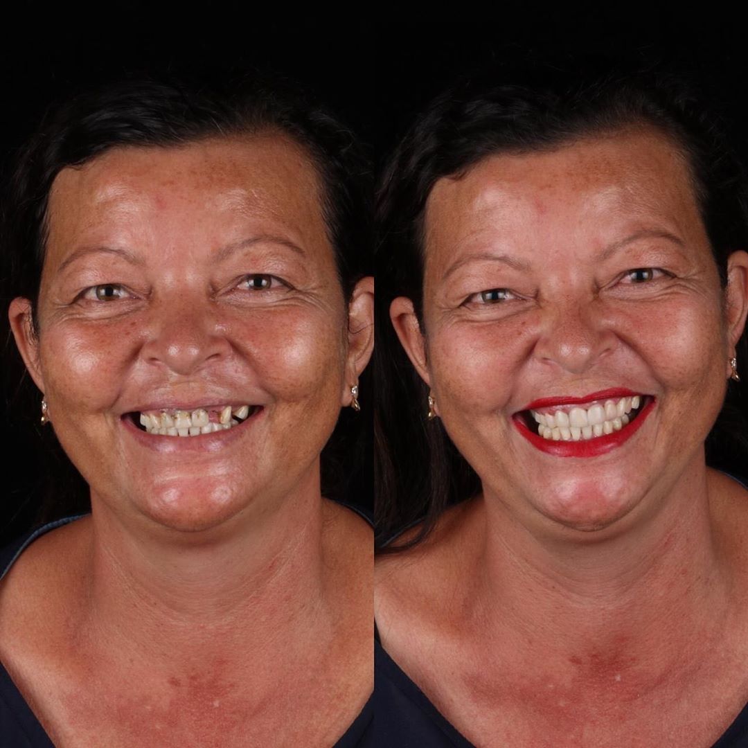 Dentista brasileiro trata dentes de pessoas pobres gratuitamente sabiaspalavras.com - Dentista brasileiro trata dentes de pessoas pobres gratuitamente