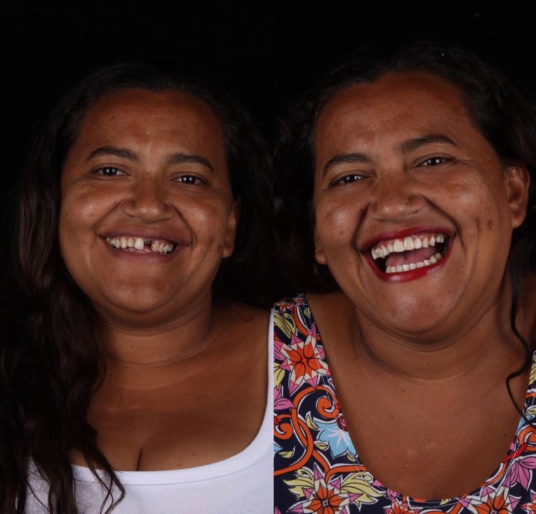 sabiaspalavras.com - Dentista brasileiro trata dentes de pessoas pobres gratuitamente