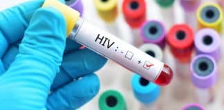 Cientistas descobrem como eliminar vírus HIV de células infectadas