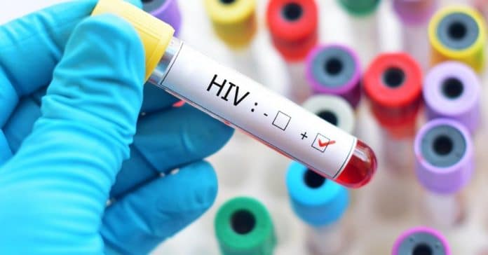 Cientistas descobrem como eliminar vírus HIV de células infectadas