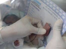 Bebé prematuro de apenas 580 gramas venceu o COVID-19