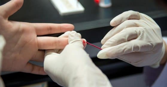 sabiaspalavras.com - Cientistas descobrem como eliminar vírus HIV de células infectadas