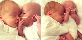 Pais dizem que bebê nascido com apenas 480 g ‘continuou lutando’ graças aos carinhos do irmão gêmeo