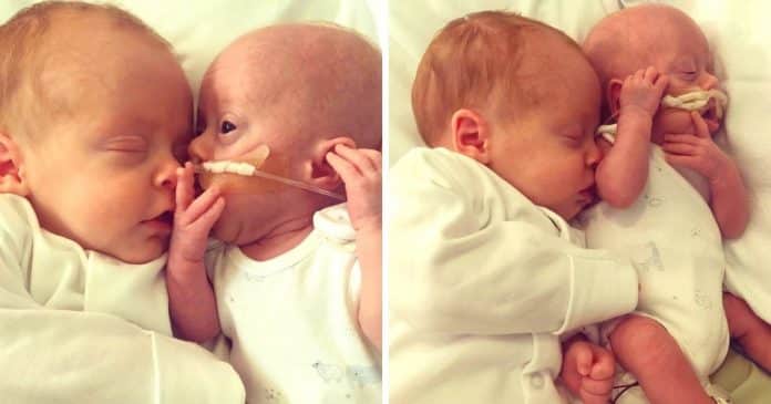 Pais dizem que bebê nascido com apenas 480 g ‘continuou lutando’ graças aos carinhos do irmão gêmeo