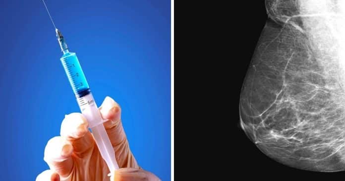 Uma nova vacina contra o câncer de mama conseguiu eliminar a doença em uma mulher