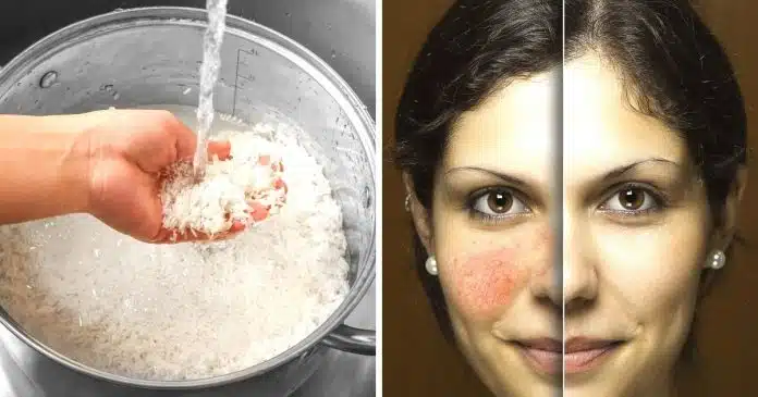conheca-os-beneficios-da-agua-de-arroz-para-a-pele-e-o-cabelo Conheça os benefícios da água de arroz para a pele e o cabelo