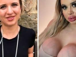 ‘Meus pais me deserdaram depois que gastei uma fortuna em plásticas – mas a culpa é deles’