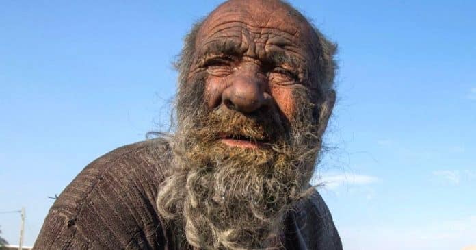 Após 60 anos sem banho, ‘Homem mais sujo do mundo’ morre após ser lavado