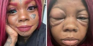 Inspirada em influencer, mulher tatua globos oculares e agora está ficando cega