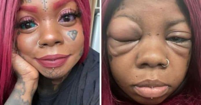 Inspirada em influencer, mulher tatua globos oculares e agora está ficando cega