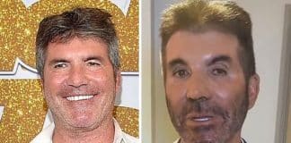 Simon Cowell, do “American Idol”, aparece com rosto irreconhecível