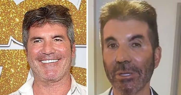 Simon Cowell, do “American Idol”, aparece com rosto irreconhecível