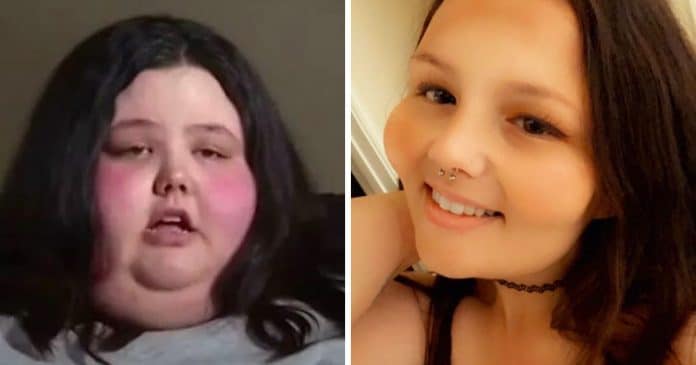 Uma das mulheres mais obesas do mundo ficou irreconhecível depois de perder 227Kg