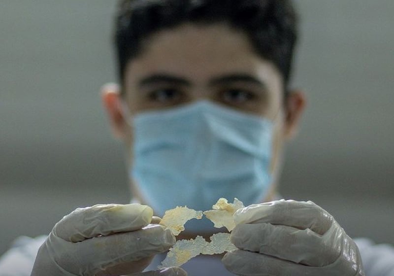 sabiaspalavras.com - Estudante cearense desenvolve plástico biodegradável a partir de batatas: alternativa para sacolas de supermercado