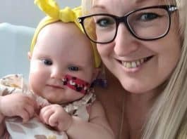 Tumor cerebral de bebê é detectado após mãe notar crescimento “anormal” na cabeça