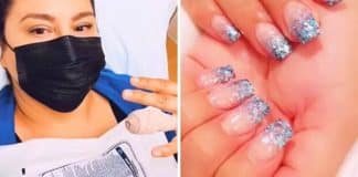 Mulher desenvolve câncer de pele após corte de manicure em salão de beleza