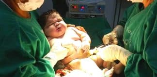 RECORDE: ‘Bebê Gigante’ nasce com mais de 7kg no Amazonas