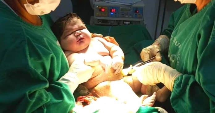 RECORDE: ‘Bebê Gigante’ nasce com mais de 7kg no Amazonas