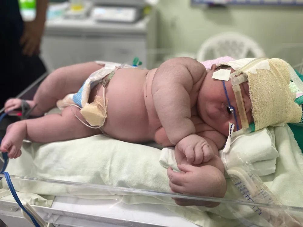 sabiaspalavras.com - RECORDE: 'Bebê Gigante' nasce com mais de 7kg no Amazonas