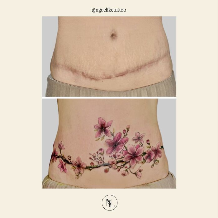 sabiaspalavras.com - Tatuador cobre com arte cicatrizes de mulheres recuperando confiança de seus corpos