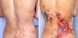 Tatuador cobre com arte cicatrizes de mulheres recuperando confiança de seus corpos