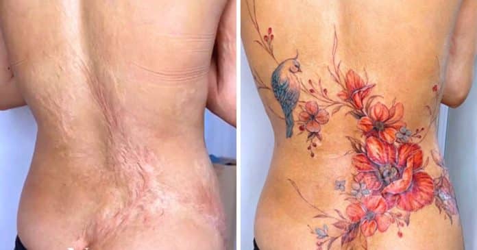 Tatuador cobre com arte cicatrizes de mulheres recuperando confiança de seus corpos