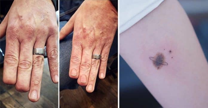 13 tatuagens que transformaram cicatrizes e marcas de nascença em obras de arte