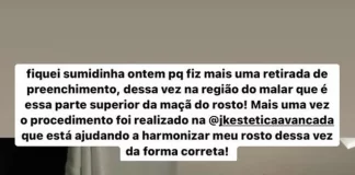 Gkay está em “desarmonização facial” e mostra antes e depois dos excessos de procedimentos