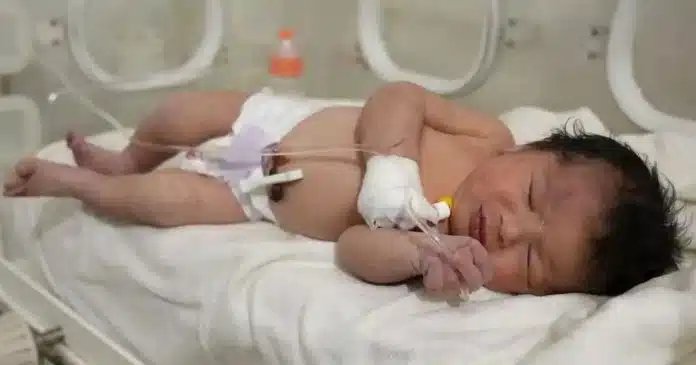 recem-nascida-retirada-dos-escombros-na-siria-ainda-estava-ligada-a-mae-por-cordao-umbilical Recém-nascida retirada dos escombros na Síria ainda estava ligada à mãe por cordão umbilical
