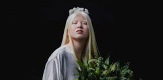 A inspiradora jornada da modelo albina abandonada na China