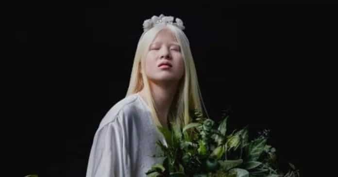 A inspiradora jornada da modelo albina abandonada na China
