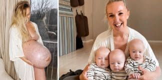 Mãe de trigêmeos revela no Instagram sua barriga antes e depois do parto – “Isso é insano!”