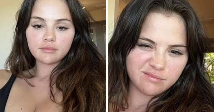 Selena Gomez inspira com sua autoconfiança ao exibir beleza natural, com “imperfeições”