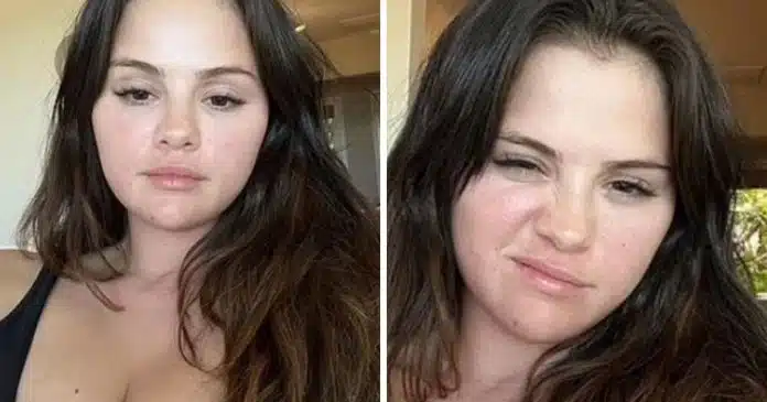 selena-gomez-inspira-com-sua-autoconfianca-ao-exibir-beleza-natural Selena Gomez inspira com sua autoconfiança ao exibir beleza natural, com “imperfeições”
