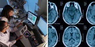 Cientistas descobrem uma possível forma de reverter a doença de Alzheimer
