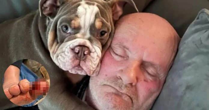 Filhote de Bulldog mastigou o dedo do dono “até o osso” e salvou a perna dele