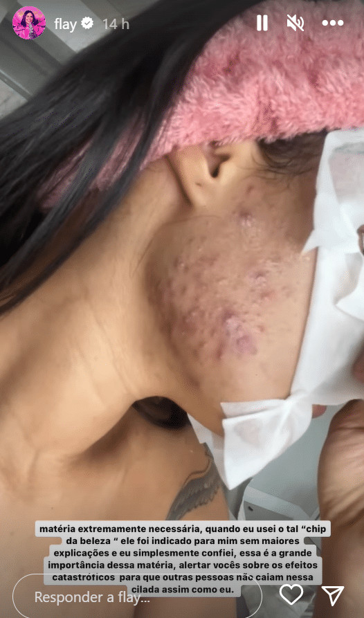 sabiaspalavras.com - Flay choca ao mostrar rea&ccedil;&atilde;o ap&oacute;s usar chip da beleza: 'Efeitos catastr&oacute;ficos'