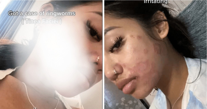 Mulher compartilha o horror de contrair micose por não lavar seus pincéis de maquiagem