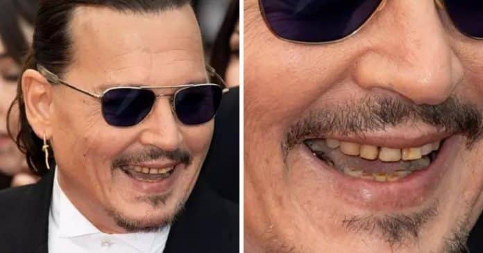 Dentes podres de Johnny Depp em Cannes gera repercussão nas redes sociais