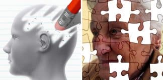 Esperança: O caso do homem com Alzheimer, mas sem sintomas de demência