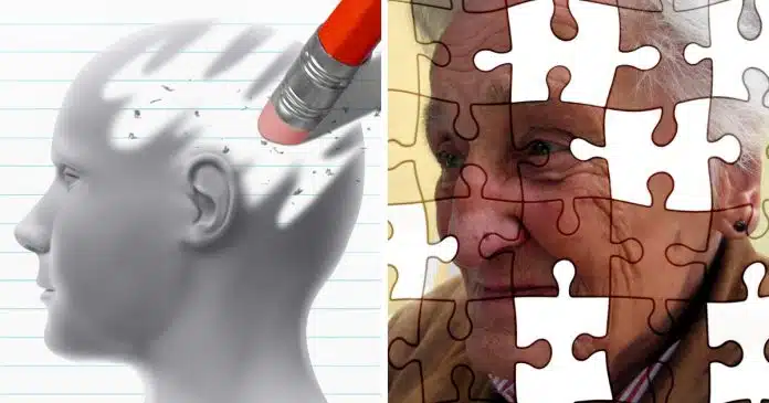 esperanca-o-caso-do-homem-com-alzheimer-mas-sem-sintomas-de-demencia Esperança: O caso do homem com Alzheimer, mas sem sintomas de demência